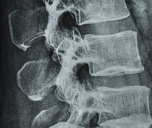 advanced spine and pain